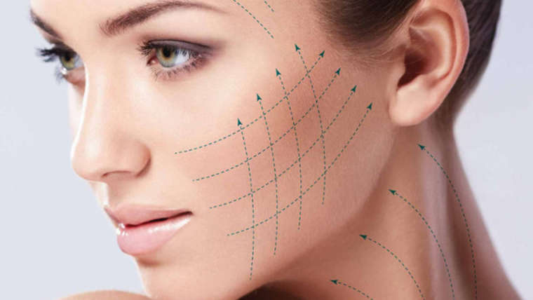 Face & Neck Thread lift